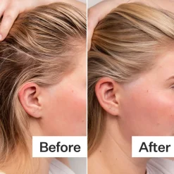 Act+Acre 4% Niacinamide Serum
