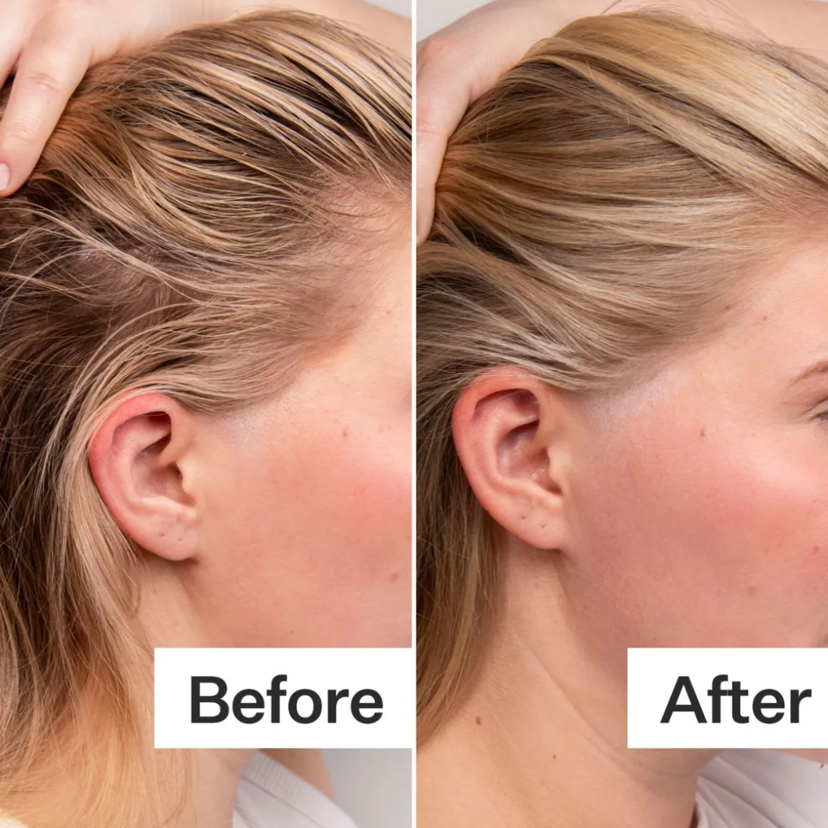 Act+Acre 4% Niacinamide Serum