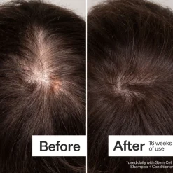 Act+Acre 3% Stem Cell Peptide Scalp Treatment 89ml
