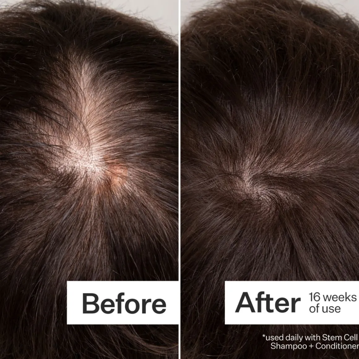 Act+Acre 3% Stem Cell Peptide Scalp Treatment 89ml