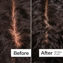 Act+Acre Microbiome Cooling Scalp Serum