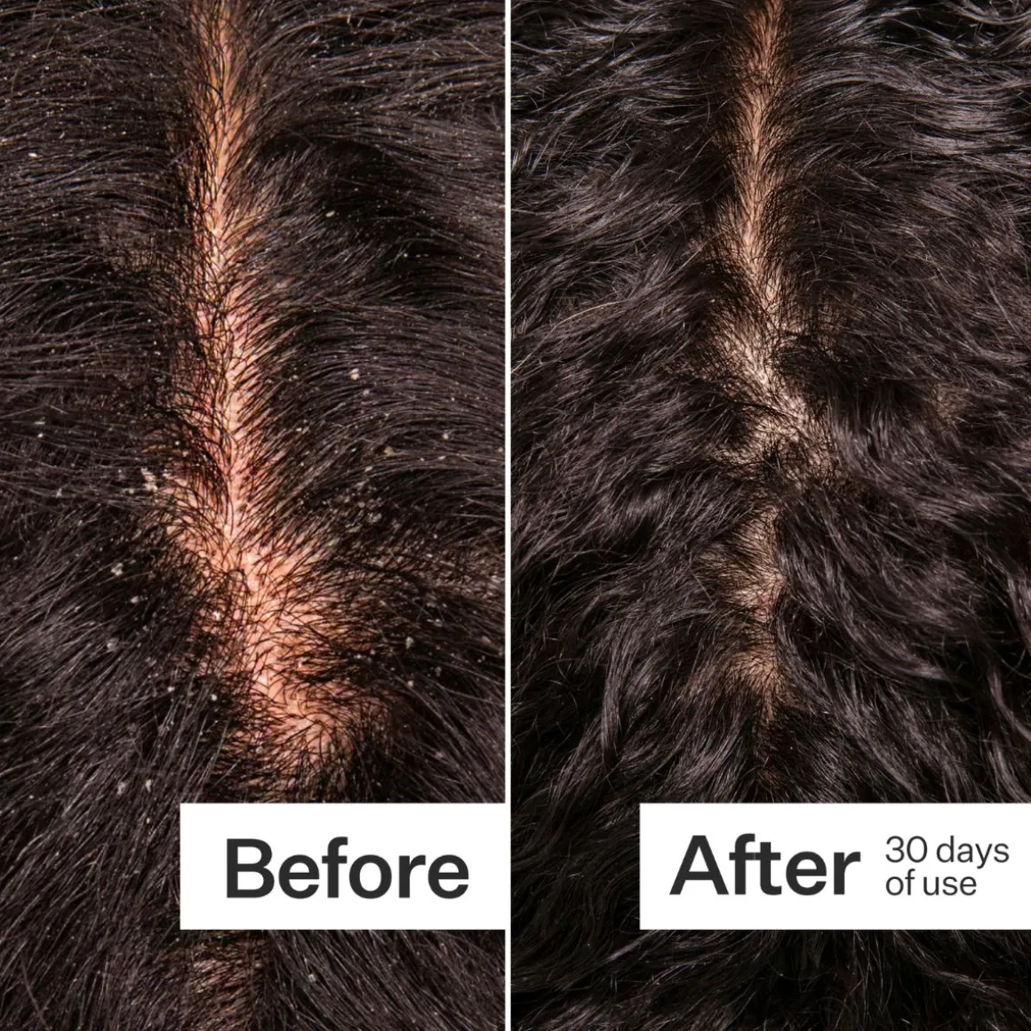 Act+Acre Microbiome Cooling Scalp Serum