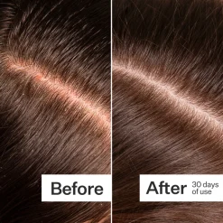 Act+Acre Microbiome Cooling Scalp Serum