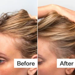 Act+Acre Oily Scalp System