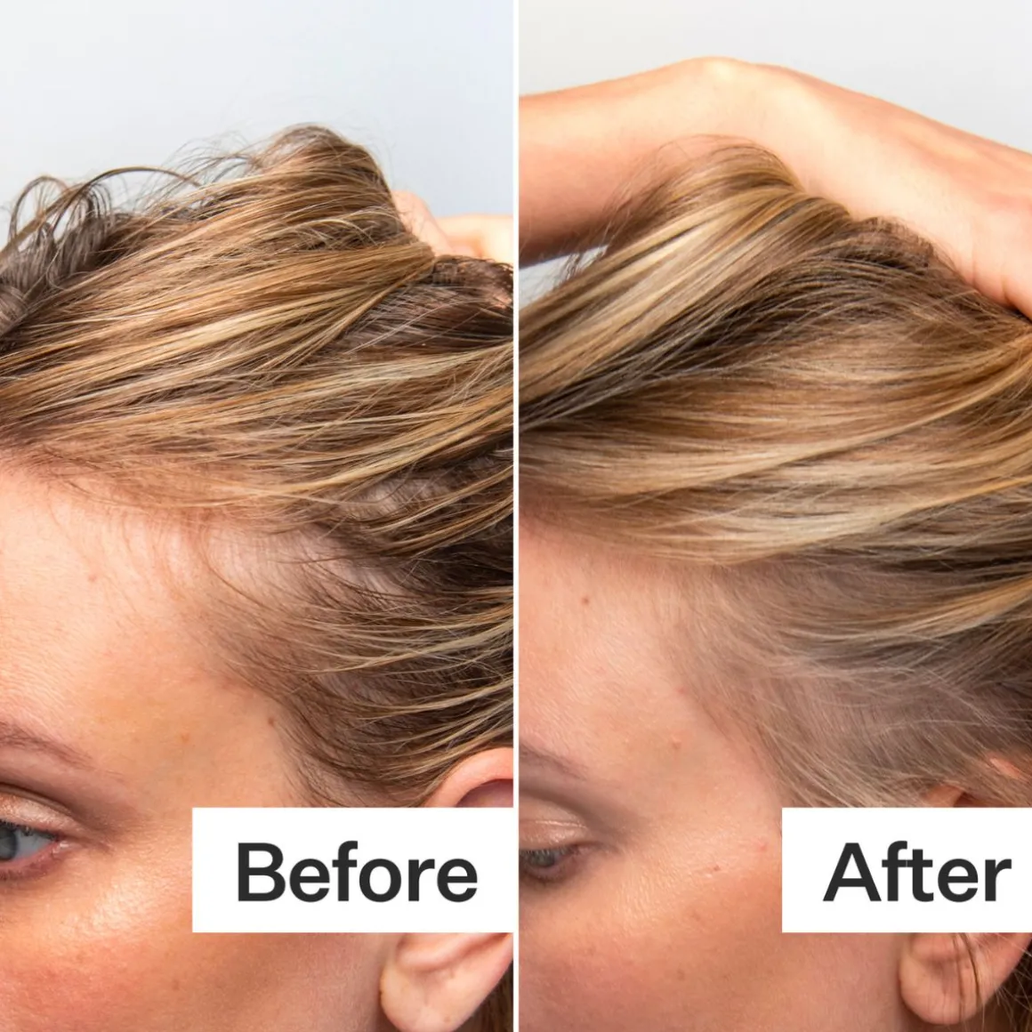 Act+Acre Oily Scalp System