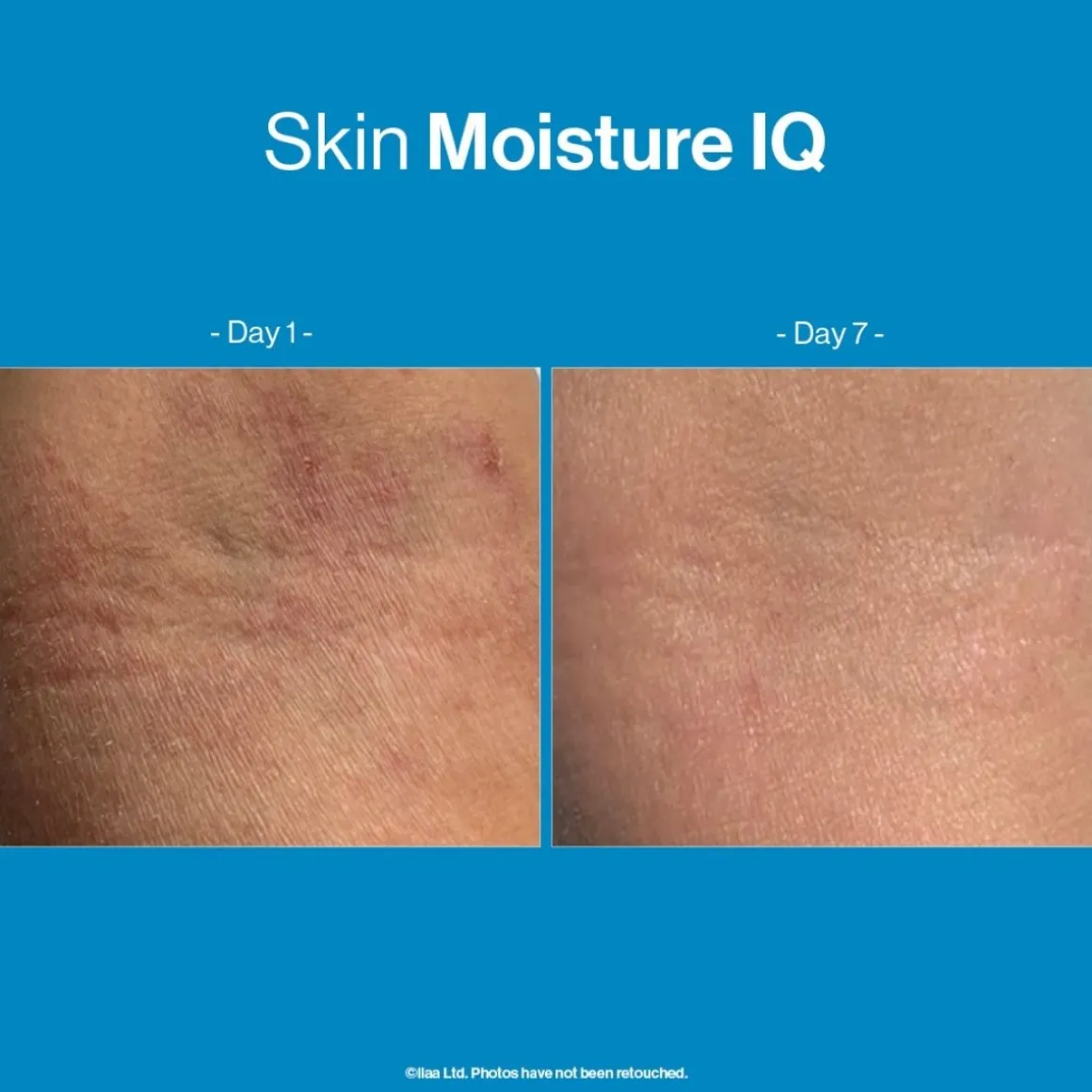 Advanced Nutrition Programme Skin Moisture IQ