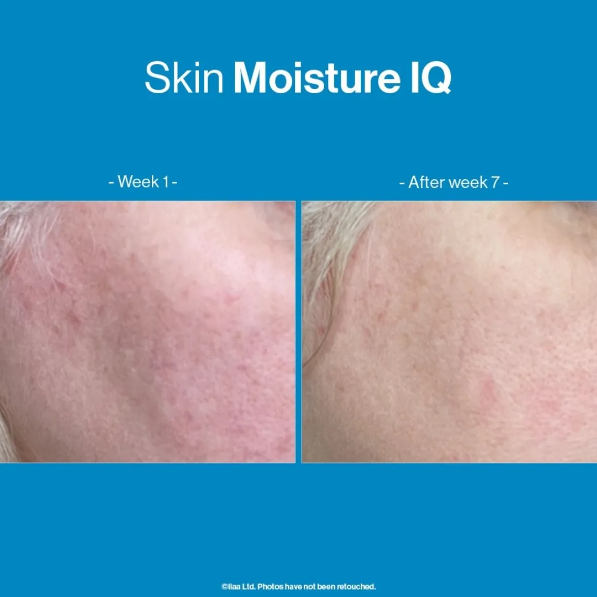 Advanced Nutrition Programme Skin Moisture IQ