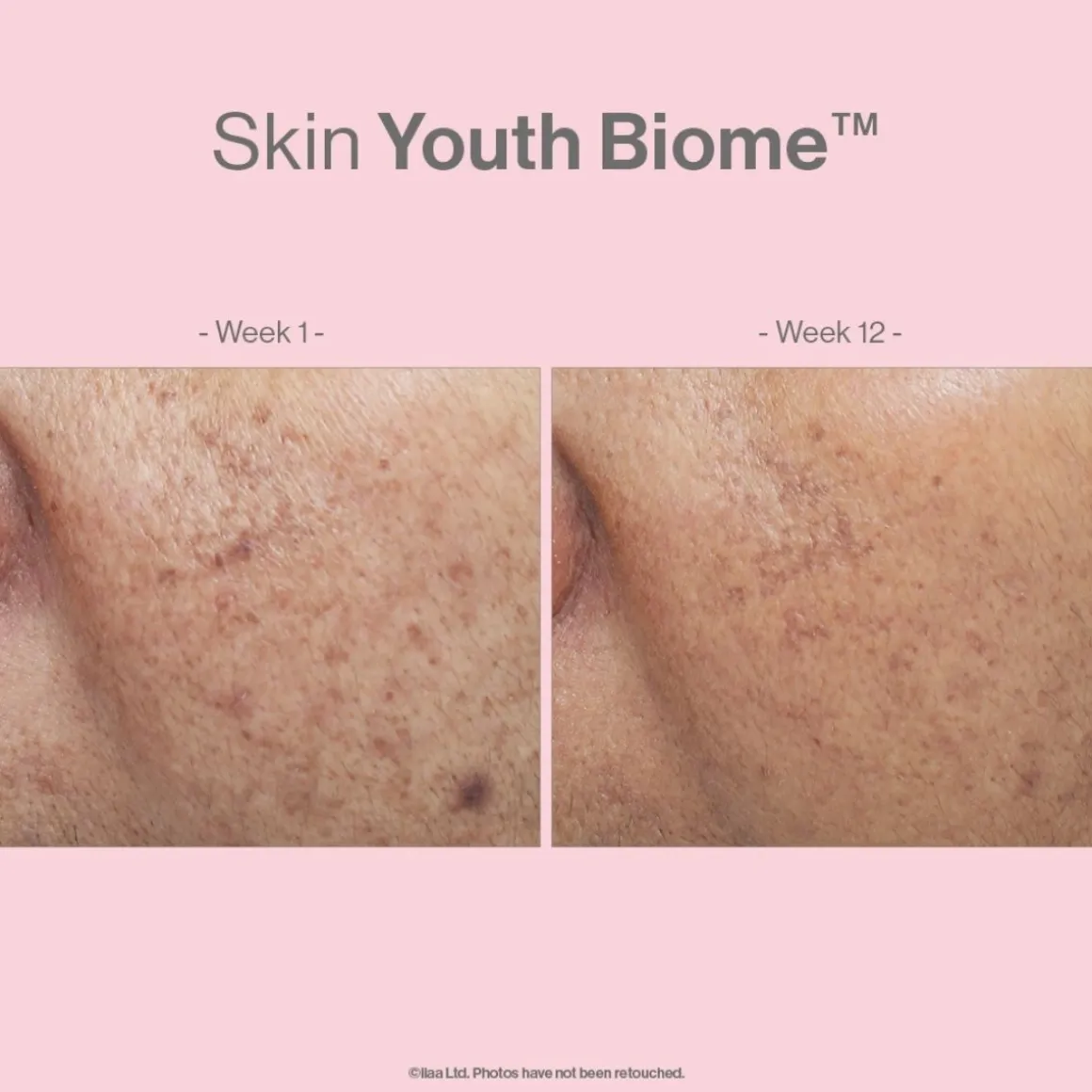 Advanced Nutrition Programme Bestseller Skin Youth Biome New & Improved 60 Capsules