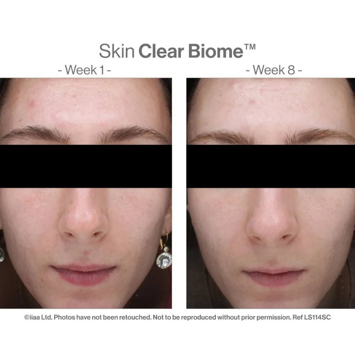 Advanced Nutrition Programme Skin Clear Biome 60 Capsules