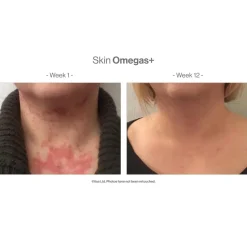 Advanced Nutrition Programme Skin Omegas + 60 Caps
