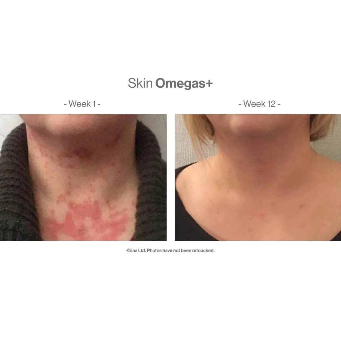 Advanced Nutrition Programme Skin Omegas + 60 Caps