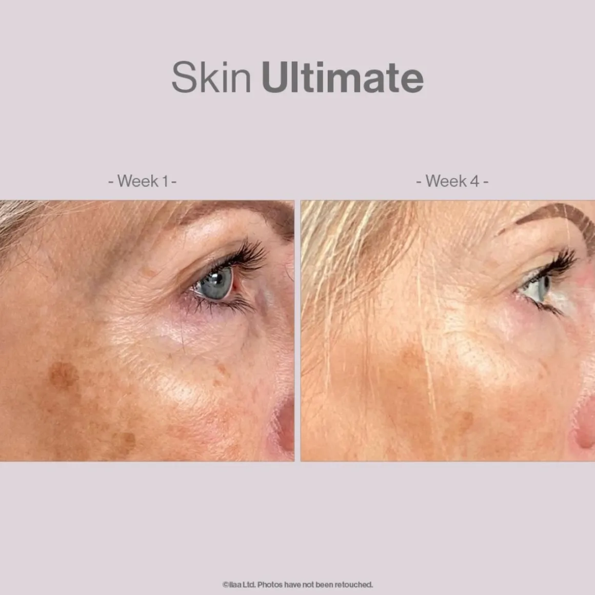 Advanced Nutrition Programme Skincare Box Ultimate