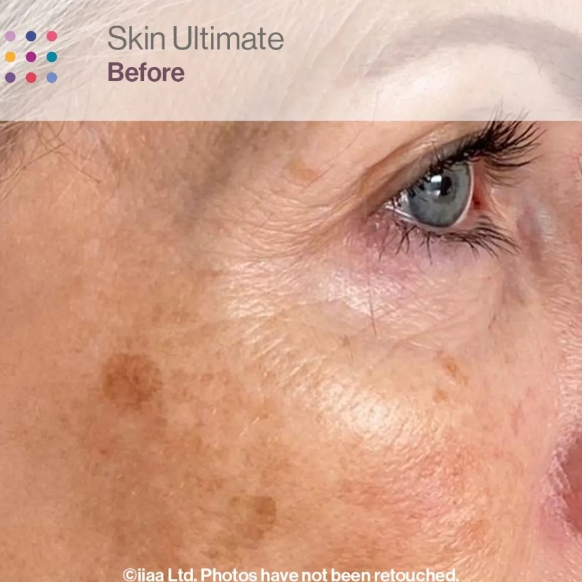 Advanced Nutrition Programme Skincare Box Ultimate