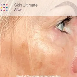 Advanced Nutrition Programme Skincare Box Ultimate