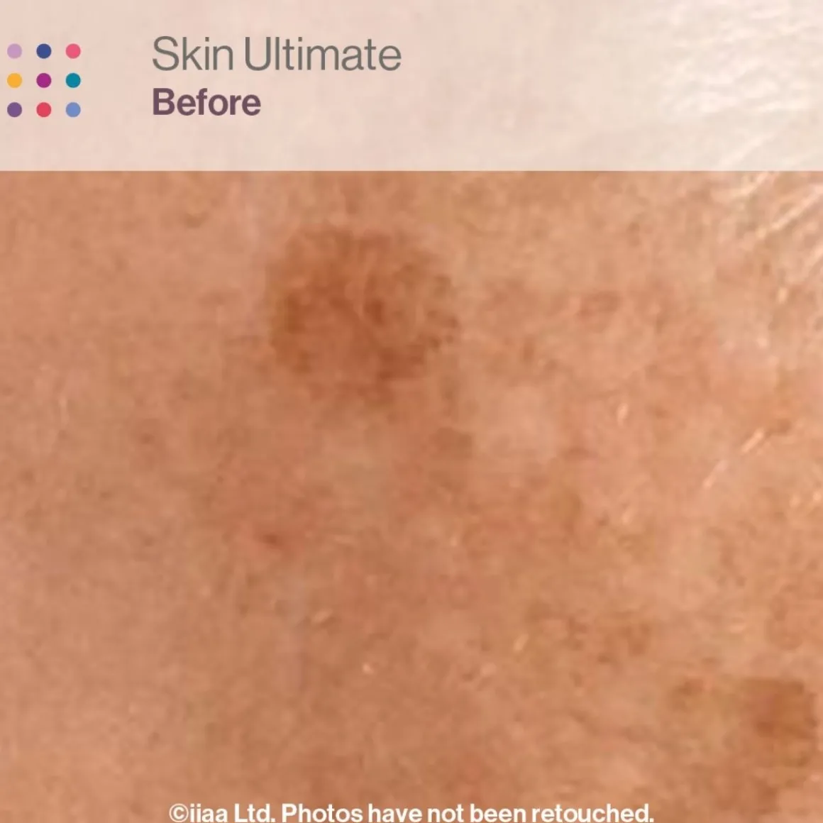 Advanced Nutrition Programme Skincare Box Ultimate
