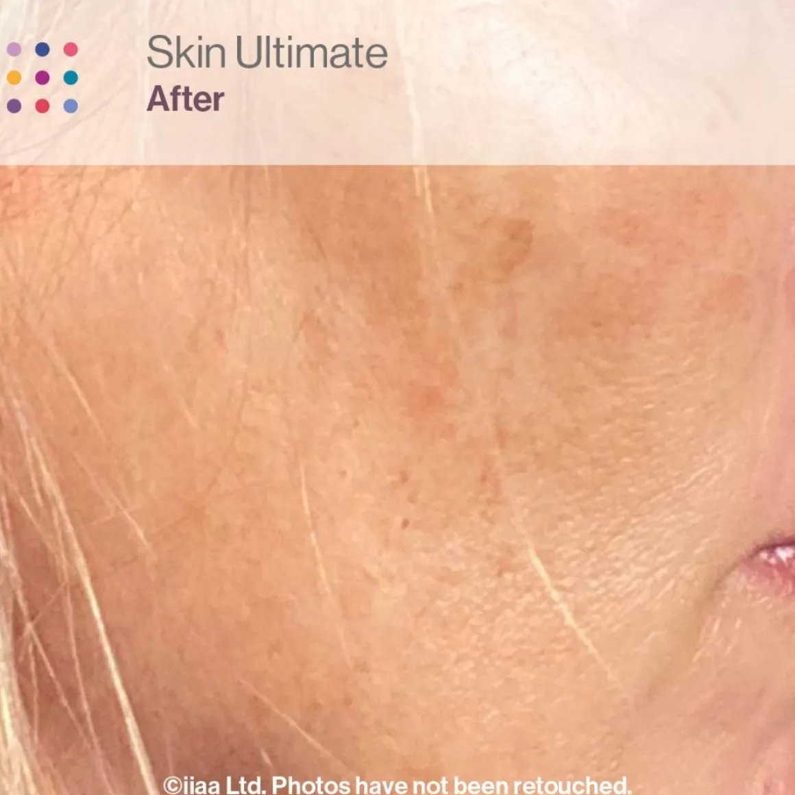 Advanced Nutrition Programme Skincare Box Ultimate