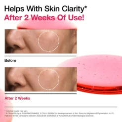 Anua Niacinamide 10%+TXA 4% Dark Spot Correcting Serum