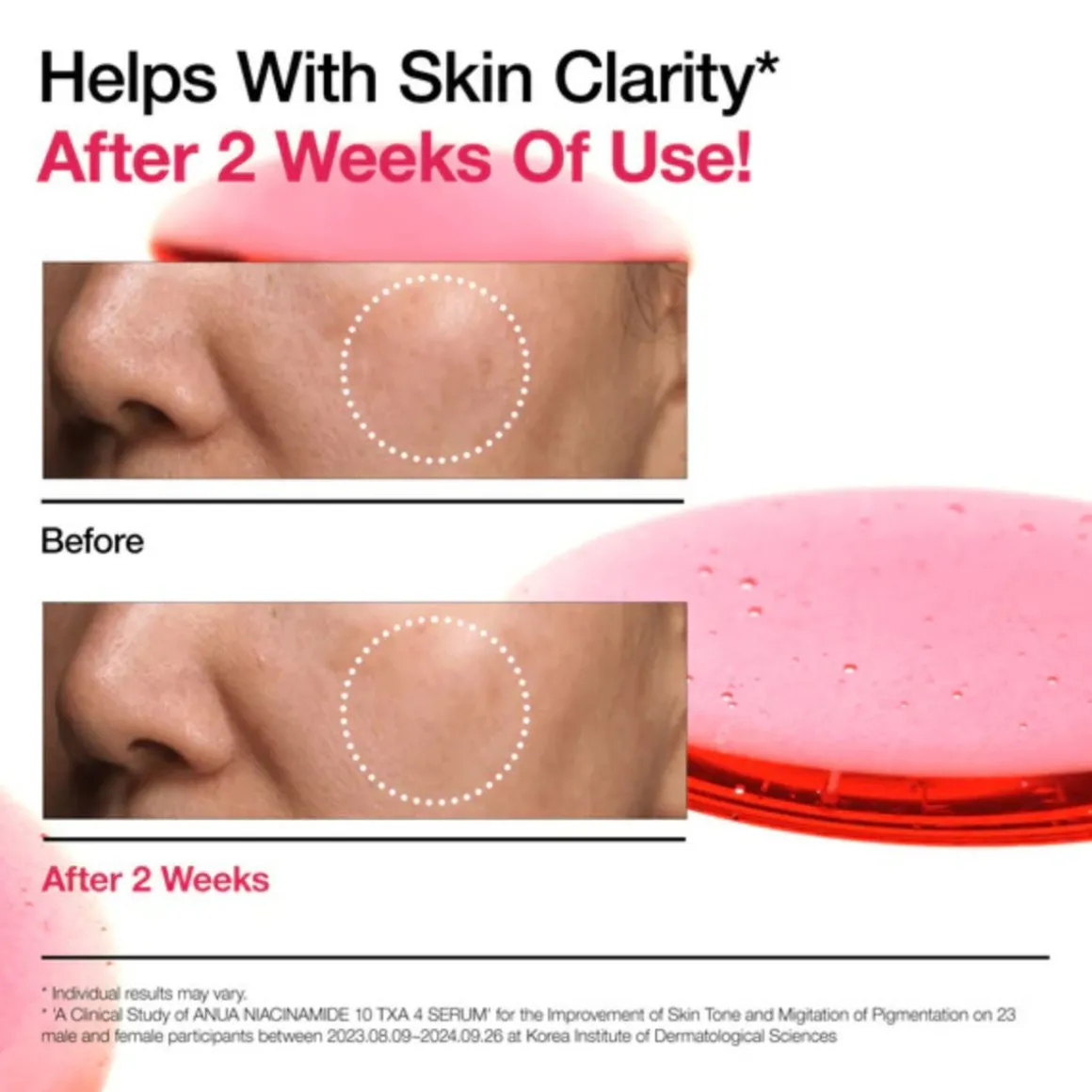 Anua Niacinamide 10%+TXA 4% Dark Spot Correcting Serum