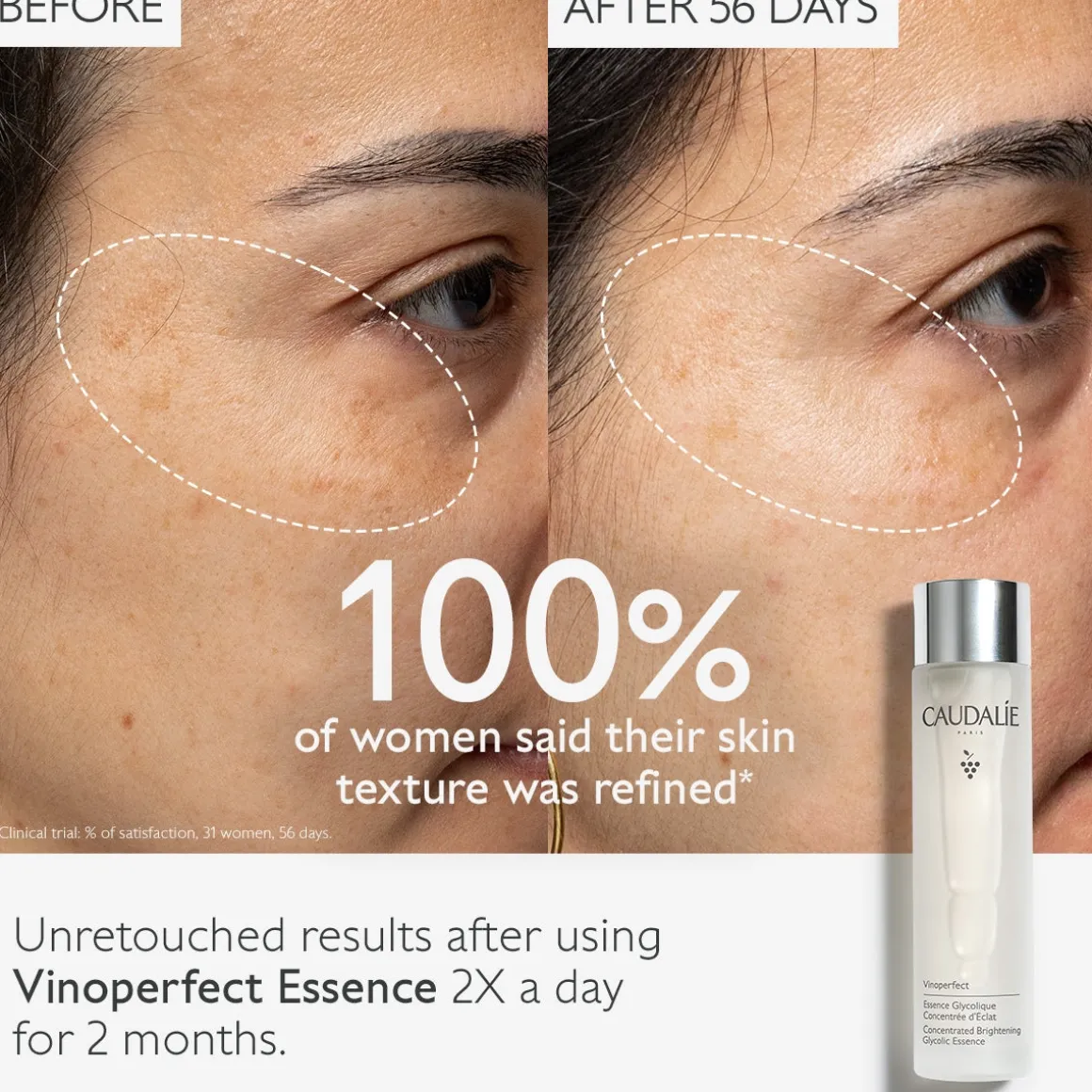 Caudalie Vinoperfect Concentrated Glycolic Essence