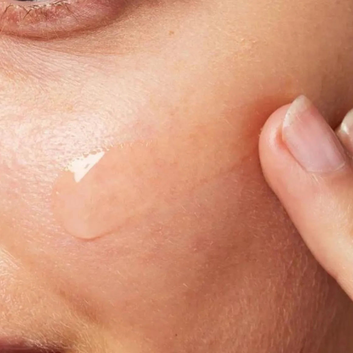 Cerave Blemish Control Gel