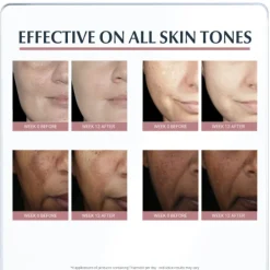 Eucerin Anti-Pigment Day SPF30 Cream