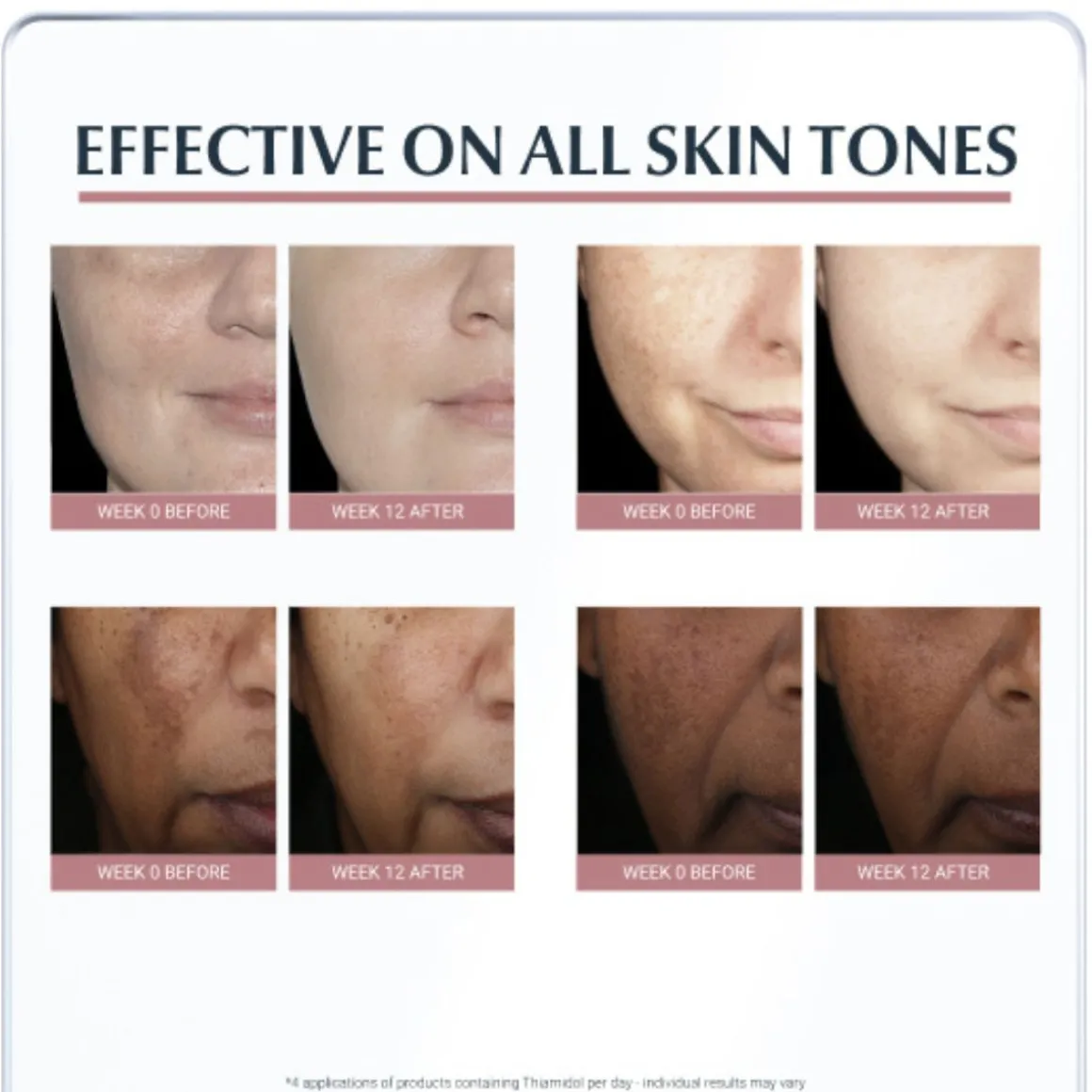 Eucerin Anti-Pigment Day SPF30 Cream