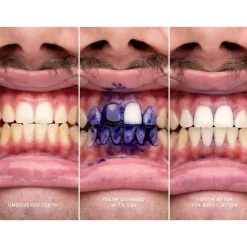 HiSmile V34 Whitening Corrector Serum