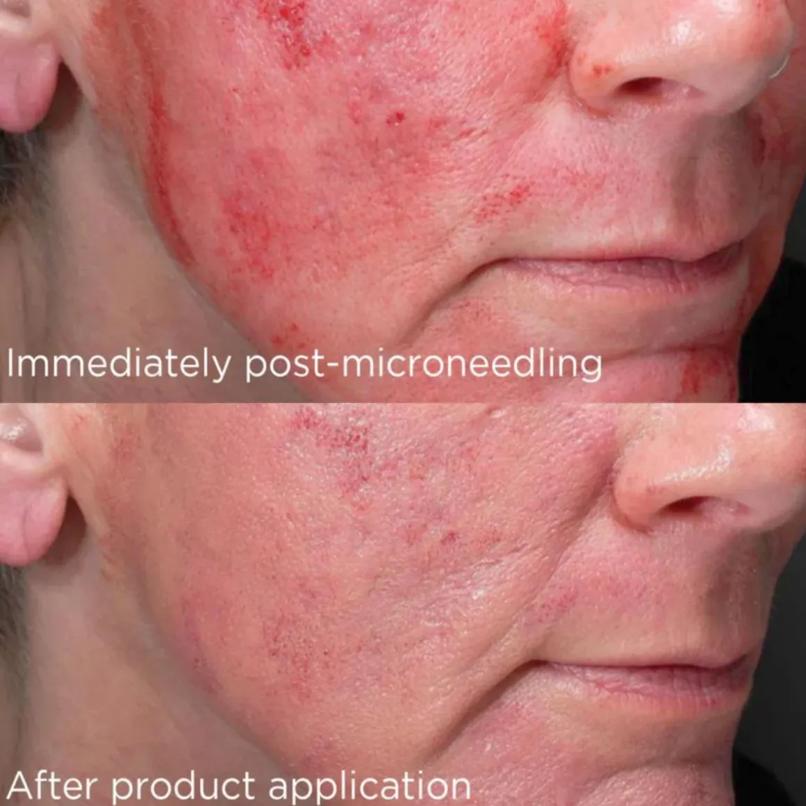 IMAGE Daily Prevention Advanced Smart Blend Mineral SPF 50