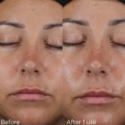IMAGE Daily Prevention Ultra Defense Moisturizer SPF 50