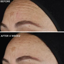 IMAGE Skincare Ageless+ Pure Liquid Retinol 0.1%