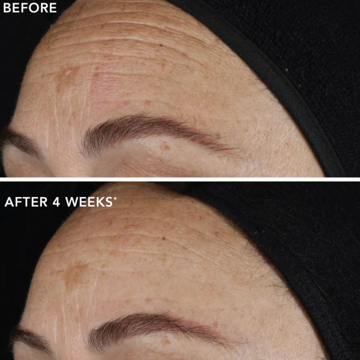 IMAGE Skincare Ageless+ Pure Liquid Retinol 0.1%