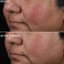 IMAGE Skincare Ageless+ Pure Liquid  Retinol 0.75% Travel Size