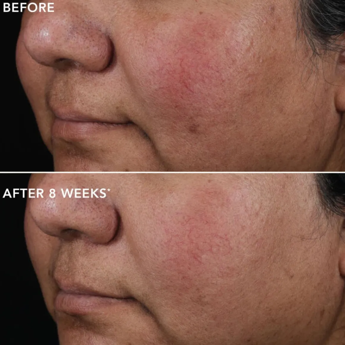 IMAGE Skincare Ageless+ Pure Liquid Retinol 0.75% Travel Size
