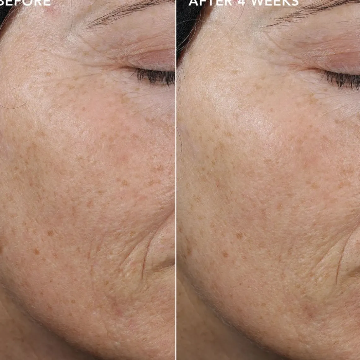 IMAGE Skincare Ageless+ Pure Liquid Retinol 0.3% Travel Size