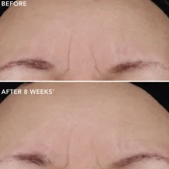 IMAGE Skincare Ageless+ Retinol Repair Creme 0.3% Retinol Complex