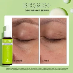 IMAGE Skincare BIOME+ Dew Bright Serum 30ml