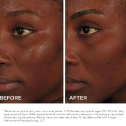 IMAGE Skincare Iluma Intense Facial Illuminator