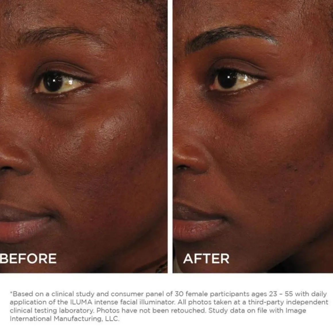 IMAGE Skincare Iluma Intense Facial Illuminator