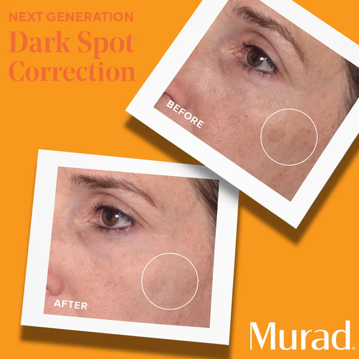 Murad Environmental Shield Rapid Dark Spot Correcting Serum