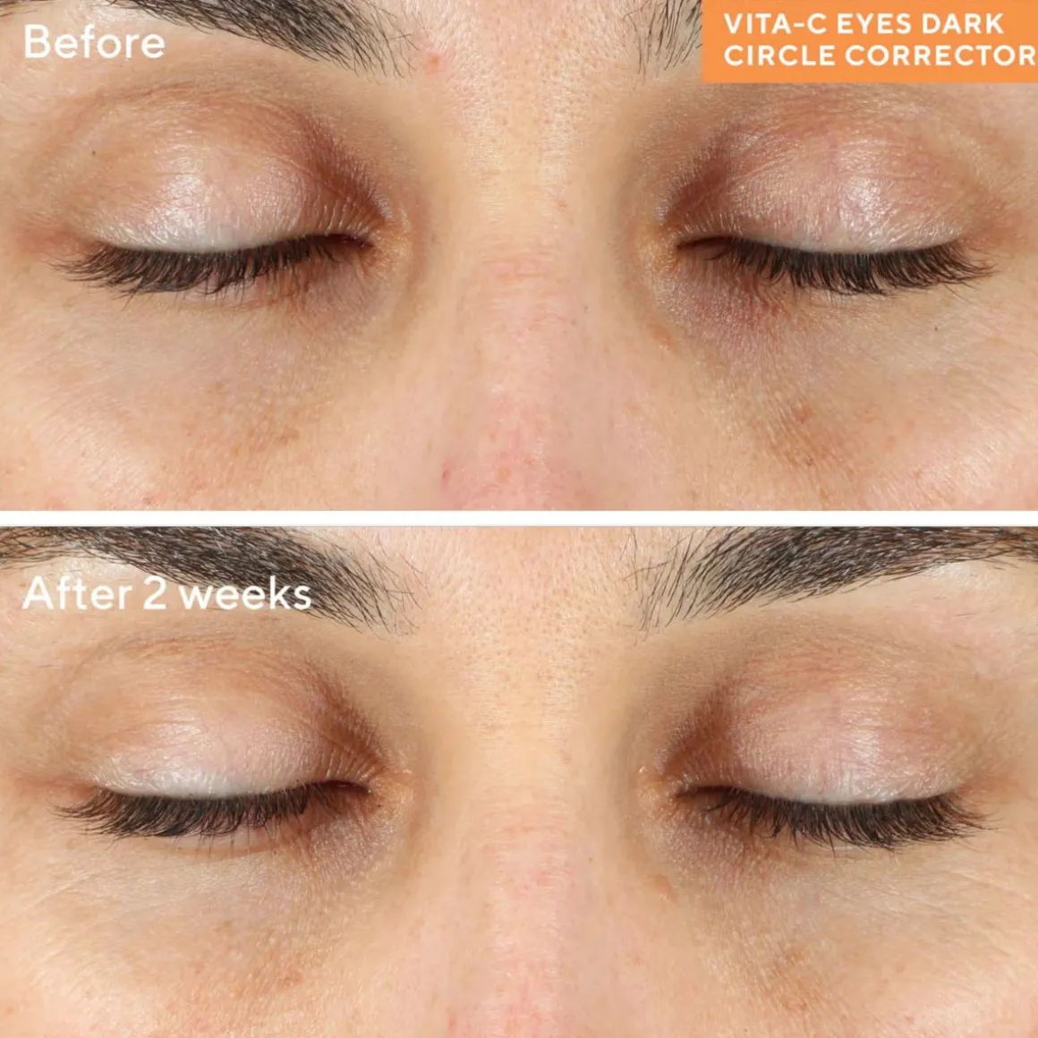 Murad Environmental Shield Vita-C Eyes Dark Circle Corrector