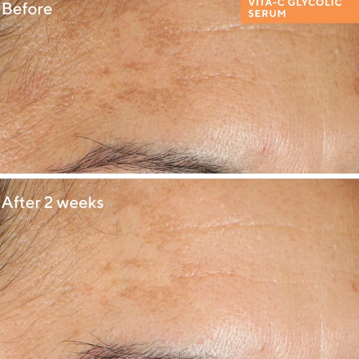 Murad Environmental Shield Vita-C Glycolic Brightening Serum
