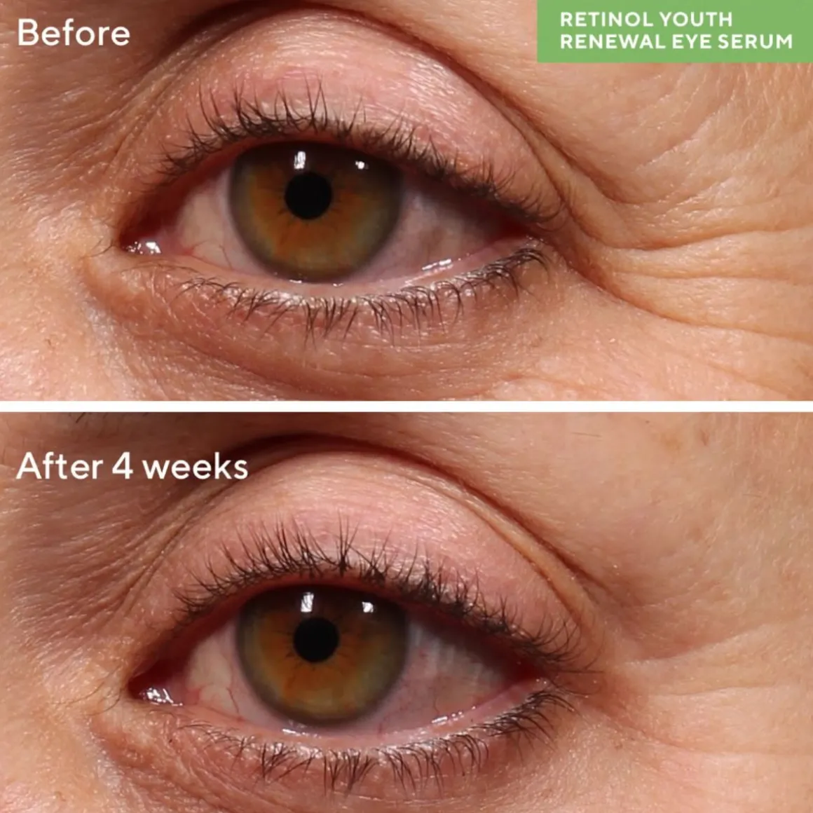 Murad Resurgence Retinol Youth Renewal Eye Serum