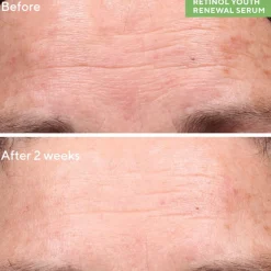 Murad Resurgence Retinol Youth Renewal Serum