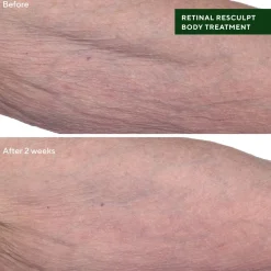 Murad Retinal ReSculpt Body Treatment