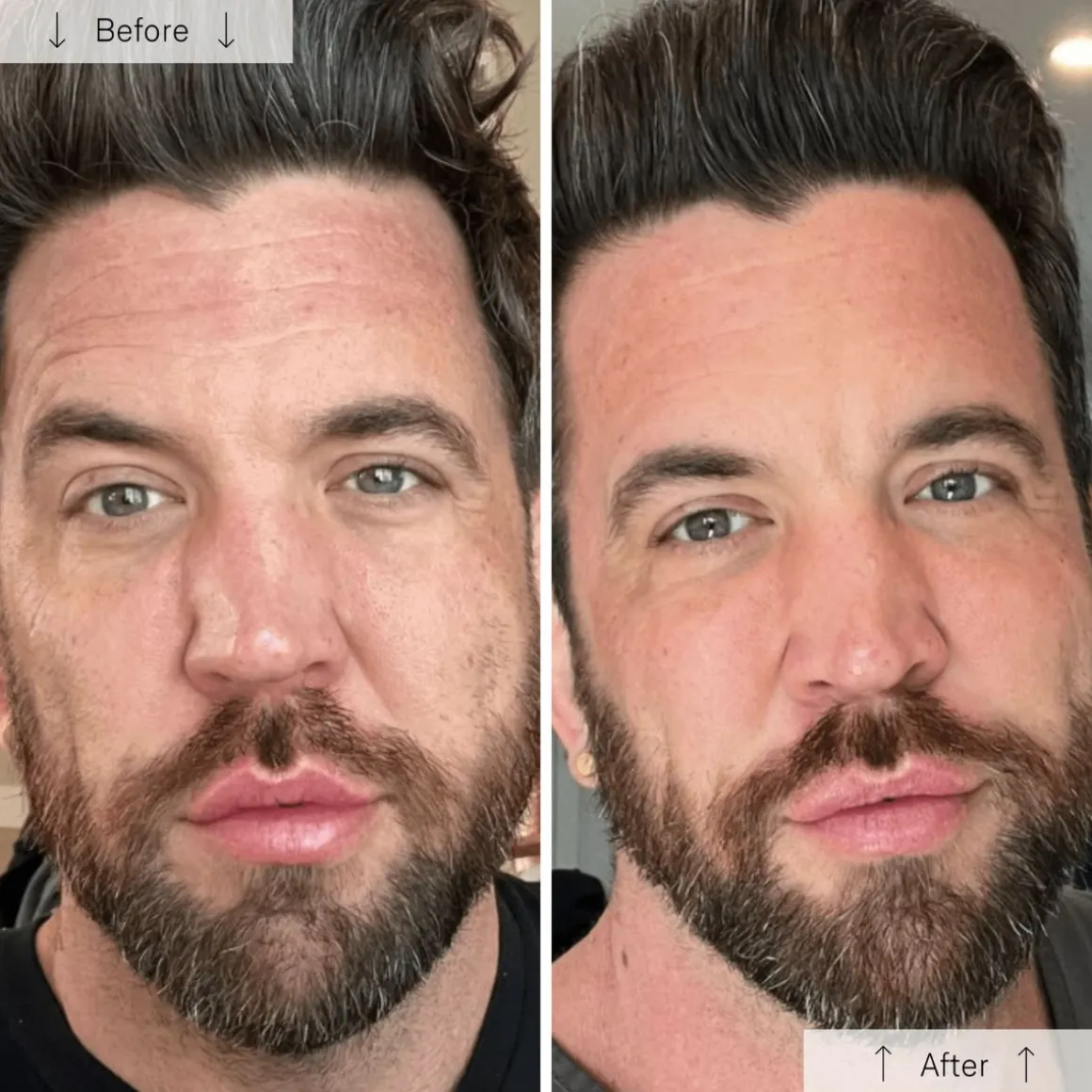 OMNILUX Contour LED Men's Face Mask