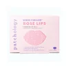 Patchology Serve Chilled Rosé Lip Gel 5-pack