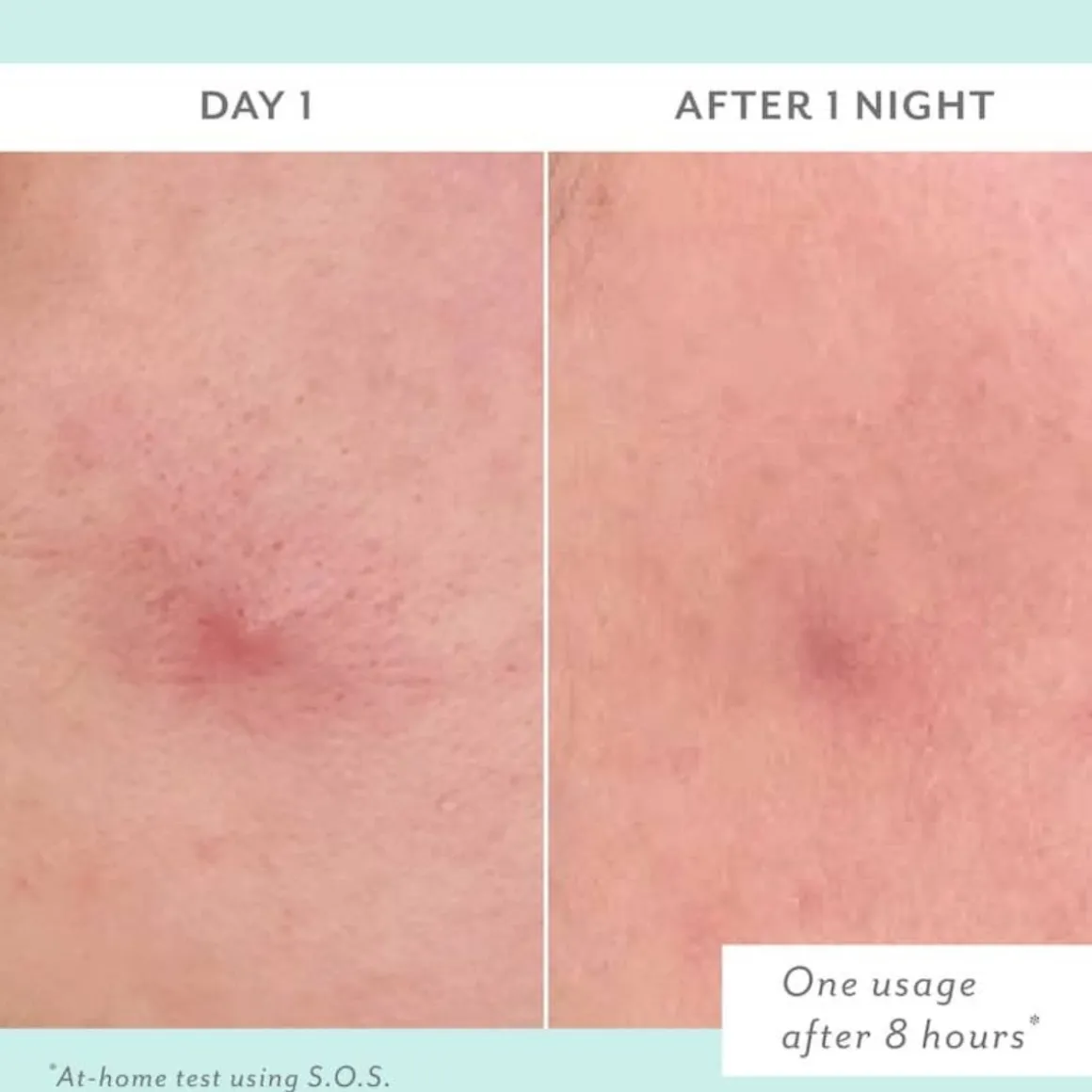 Patchology S.O.S. Totally-Invisible Clarifying Liquid Patch