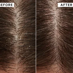 Philip Kingsley Flaky Itchy Scalp Toner 75ml
