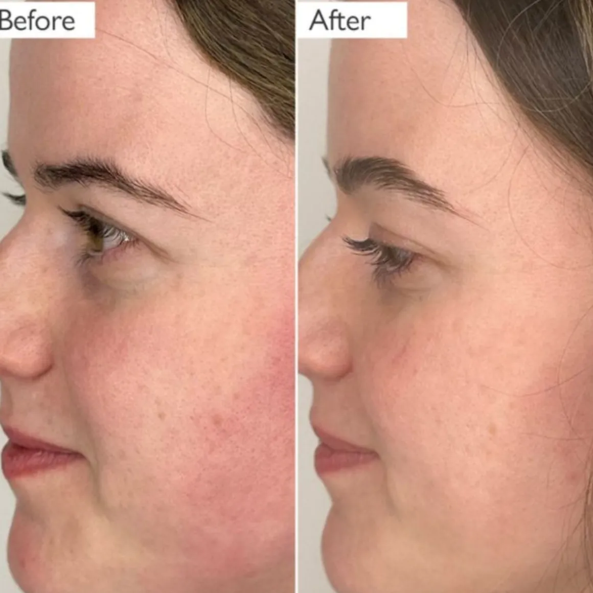 Skinician Glycolic Exfoliating Toner 100ml