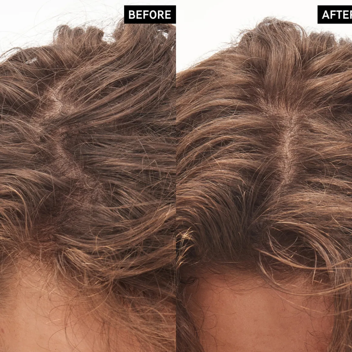 The Inkey List Glycolic Acid Exfoliating Scalp Scrub